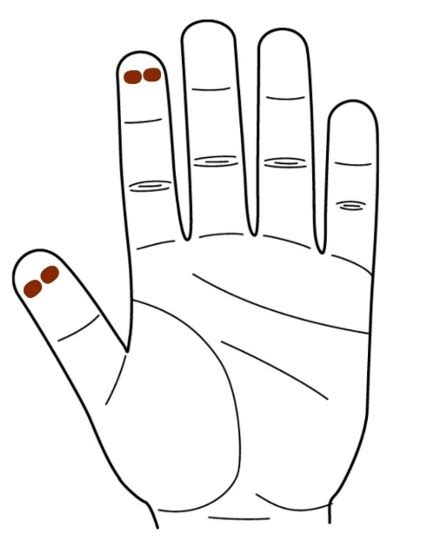 Say bye-bye to puffy eyes with THIS treatment