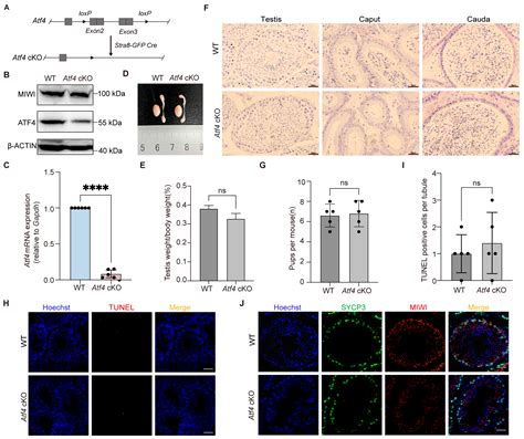 ATF4 Is Dispensable for Spermatogenesis but Protective Against ER ...