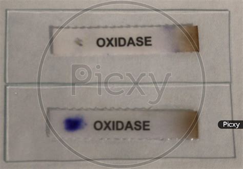 Catalase Test Negative
