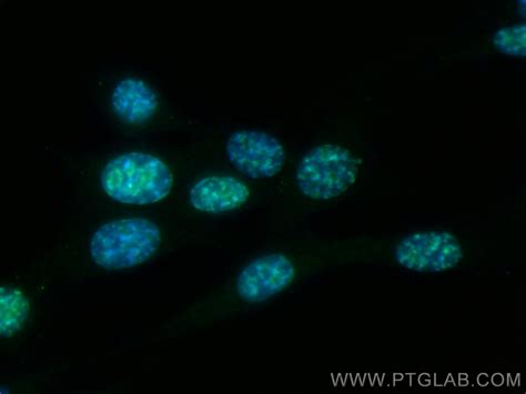 Ki-67 antibody (CL488-84432) | Proteintech