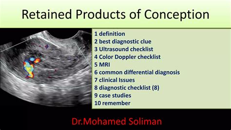Retained products of conception dr.mohamed Soliman | PDF
