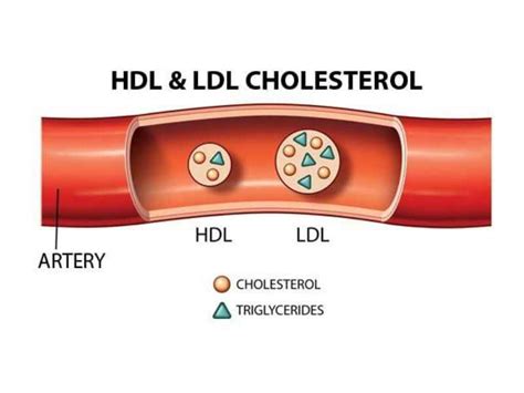 Image result for HDL Components Code