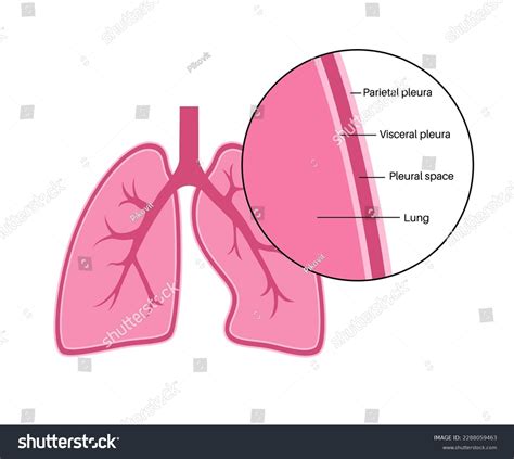 Visceral Surface Of Lung Pleura