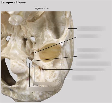 Image result for Styloid Process of Temporal Bone Inferior View