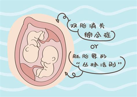关于数胎动：怎么数胎动算一次？99%的准妈妈都想知道(2) - 妈妈育儿网