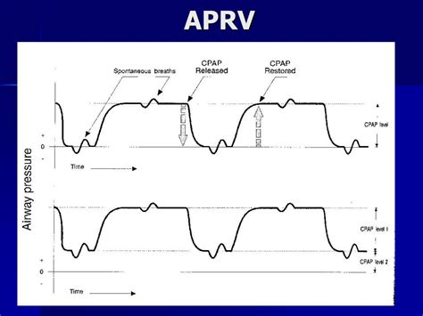 Aprv Pressure Time Graph 的图像结果