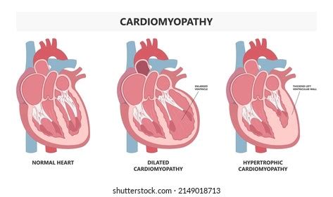 Image result for Heart with Name Using Python