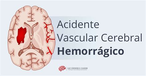 Hemorragia Cerebral: AVC Hemorrágico