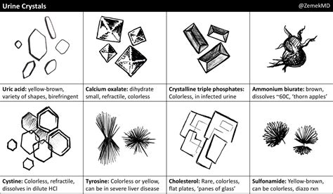 Cholesterol Crystals In Urine Sediment