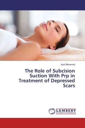 The Role of Subcision Suction With Prp in Treatment of Depressed Scars ...