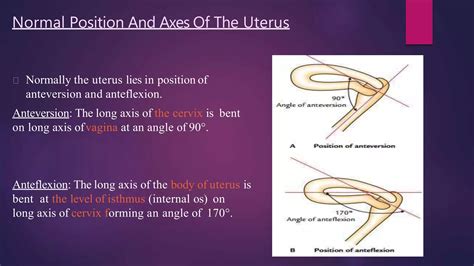 Anatomy of uterus and appendages | PPTX
