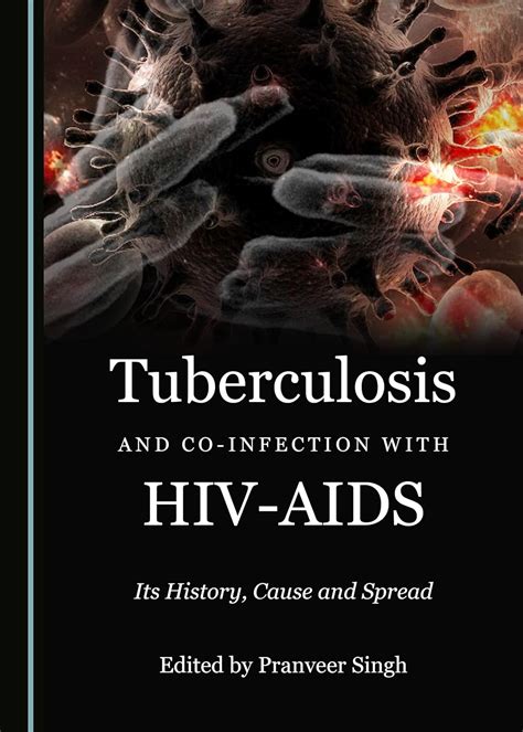 Buy Tuberculosis and Co-infection with HIV-AIDS: Its History, Cause and ...