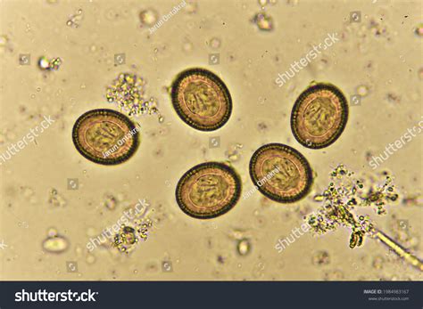Tapeworm Under Microscope Worms In Cats | PetMD