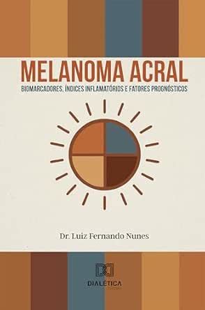 Melanoma acral: Biomarcadores, índices inflamatórios e fatores ...