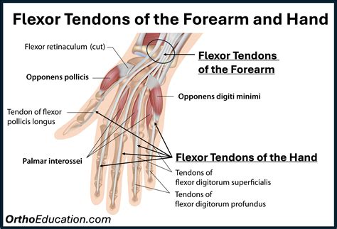 Flexor Tendon Injuries of the Hand - Hand Education