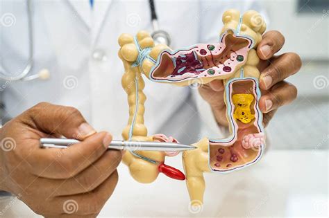 Image result for Digestive System Appendix