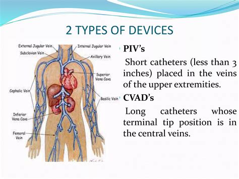 Central venous access catheter | PPTX