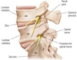 Image result for Selective Nerve Root Block