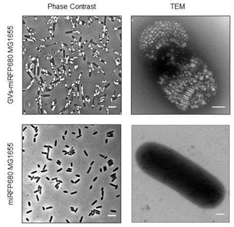 Bimodal Imaging of Tumors via Genetically Engineered Escherichia coli