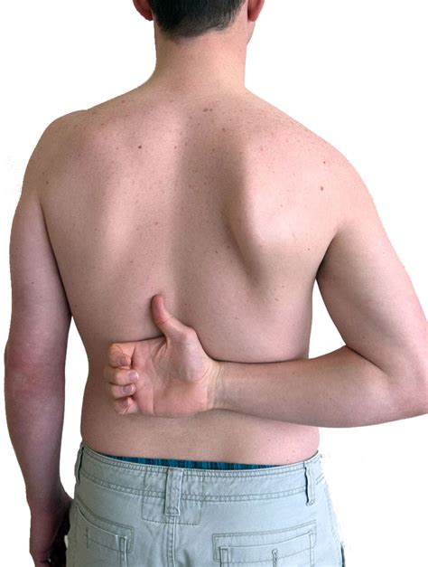 Image result for Scapular Rotation Dysfunction