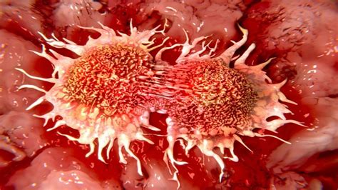 Image result for Cancer Detection Using Graph CNN