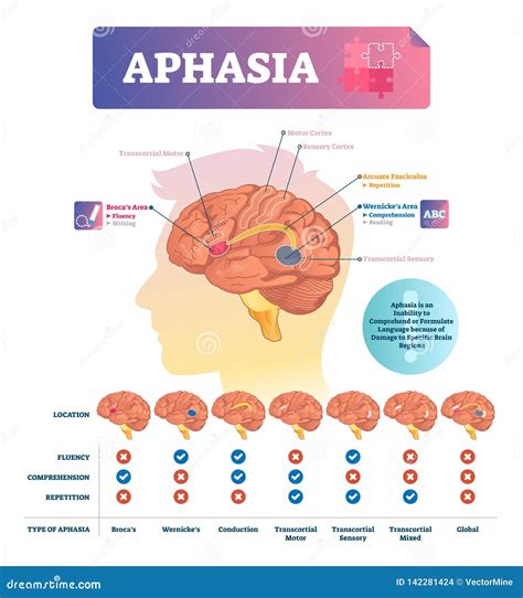 Image result for Conduction Aphasia