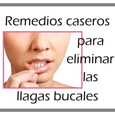 Como Curar Llagas En La Espalda at Helen Williamson blog