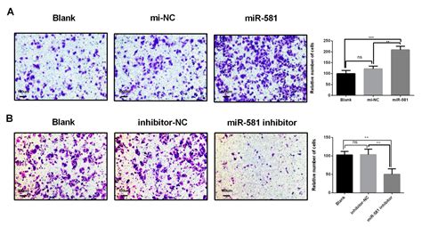 MiR-581/SMAD7 Axis Contributes to Colorectal Cancer Metastasis: A ...