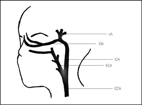 Image result for Examples of String Code
