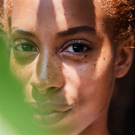 Two Moles Under Eyes