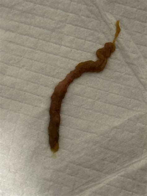 Mucus Or Worm In Stool