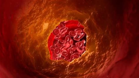 शरीर के लिए जहर हैं ये तीन सफेद चीजें, कोलेस्ट्रॉल से भर जाएंगी नसें ...