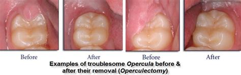 Hyderabad Dental Hospital » Oral Surgery