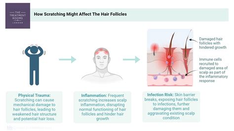 Eczema Scalp Black People