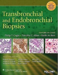 Transbronchial and Endobronchial Biopsies: Buy Transbronchial and ...