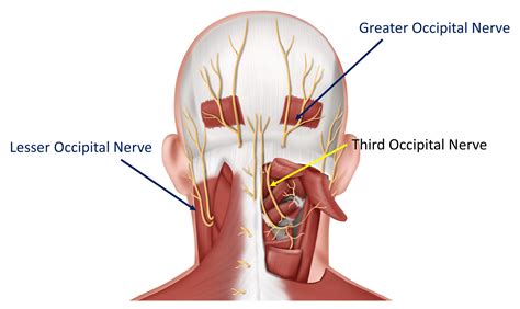 What Is a Proper Diagnostic Block Headache Work-up? - Regenexx