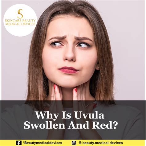 Why Is My Uvula Swollen And Red When I Wake Up at Joan Dudley blog