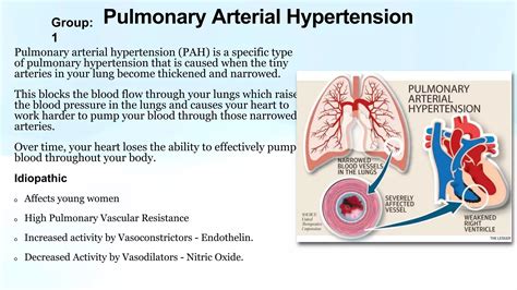 Pulmonary Hypertension.pptx