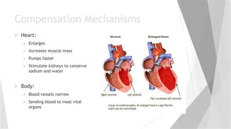 Image result for Heart Failer Compensatory Processes
