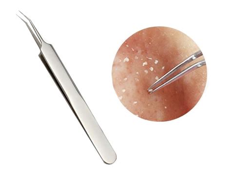 erioctry Silver Professional Remove Blackheads Tweezers Stainless Steel ...