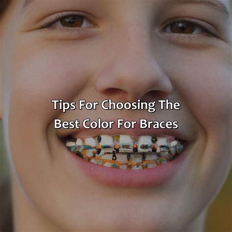 What Are The Best Band Colors For Braces at Kathryn Ono blog
