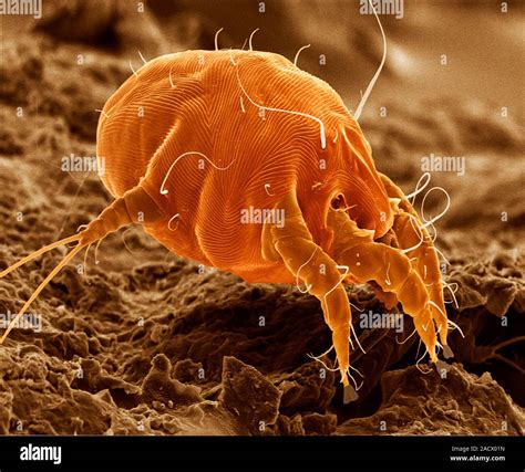 Scanning electron micrograph of an ear mite (Otodectes cynotis). Ear ...