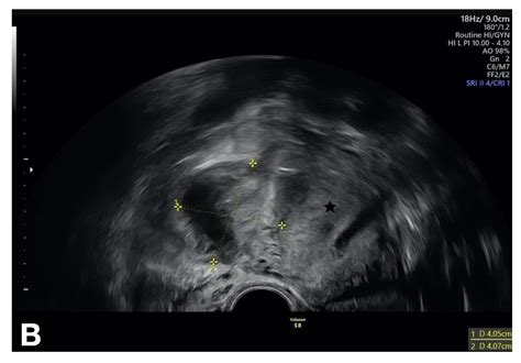 Sexually Transmitted Diseases—An Update and Overview of Current Research