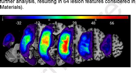 Aphasia Algorithm 的图像结果