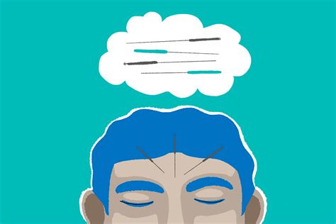 Dry Needling vs. Acupuncture: Everything You Need to Know. Nike AU