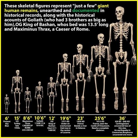 Image result for Skeleton Brain Exploding