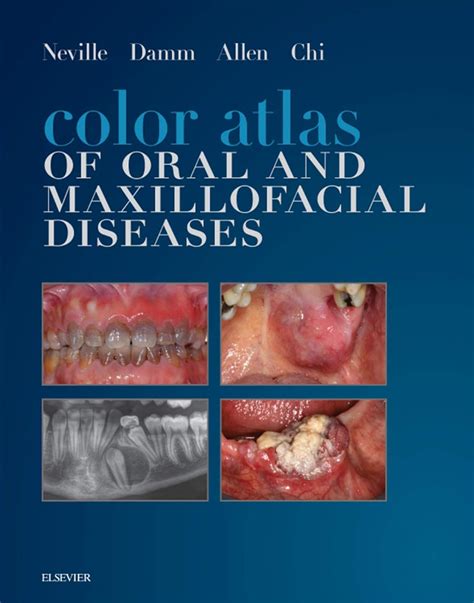 Color Atlas of Oral and Maxillofacial Diseases: Color Atlas of Oral and ...