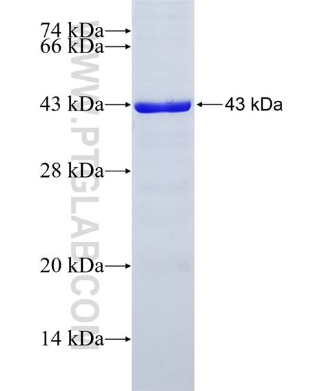 TTC28 Fusion Protein Ag22465 | Proteintech