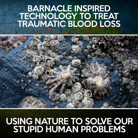 Barnacles On Humans Acorn Barnacle The Australian Museum