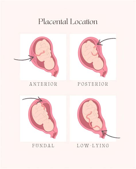 Pregnancy Guide | Linea Nigra - A common pregnancy change—here’s what you need to know! | Instagram